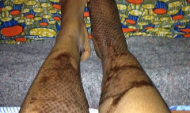 From Battle Scars to Wedding Bells